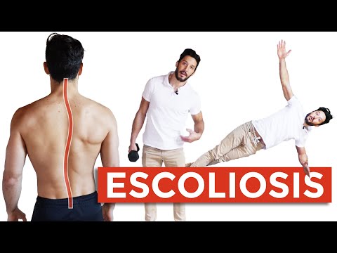 5 ejercicios para corregir la escoliosis.